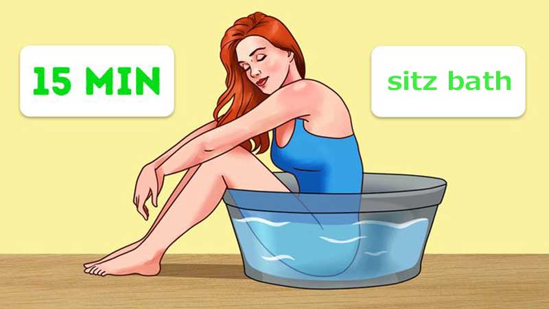 تاثیر حمام sitz در درمان بواسیر، شقاق، فیستول و کیست مویی