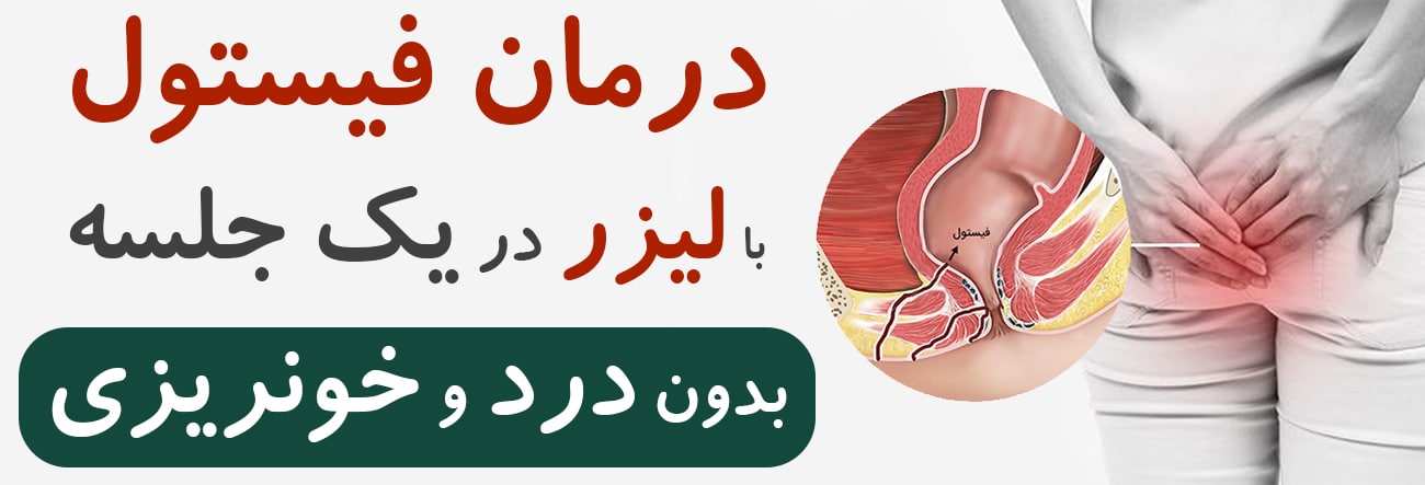درمان فیستول با لیزر و بدون جراحی در تهران