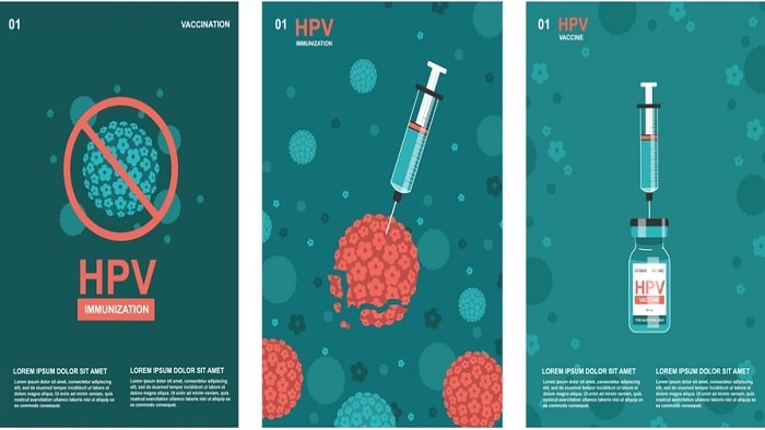 درمان زگیل تناسلی چیست