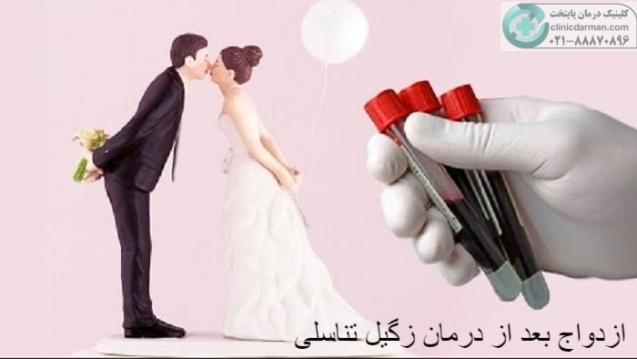 ازدواج بعد از درمان زگیل تناسلی