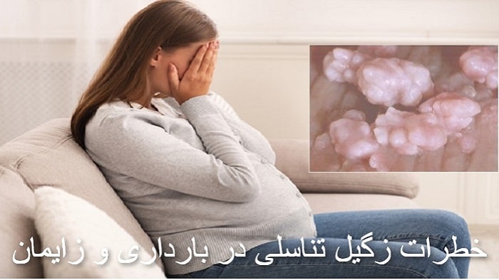 زگیل تناسلی در بارداری خطرناکه