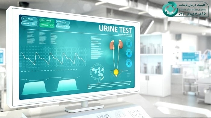 تشخیص خون در ادرار