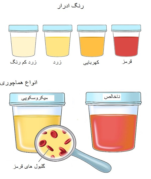 علت خون در ادرار چیست