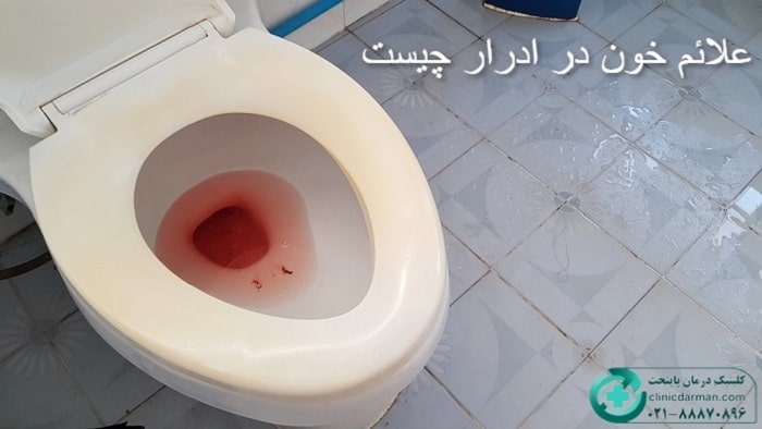 علائم خون در ادرار