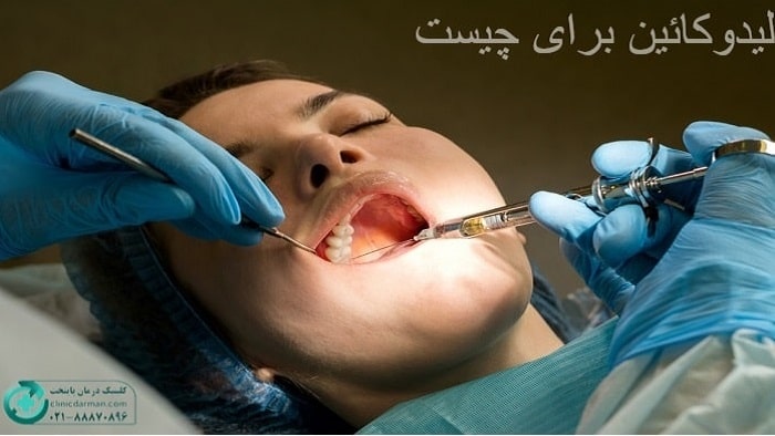 لیدوکائین برای چیست