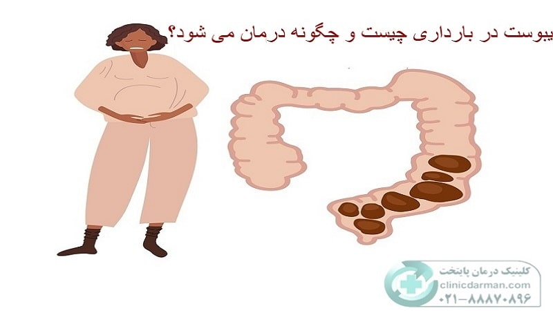 یبوست در بارداری