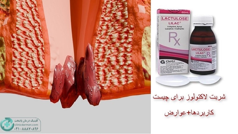 شربت لاکتولوز برای چیست