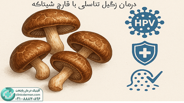 قارچ شیتاکه برای زگیل تناسلی