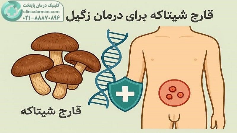 درمان زگیل تناسلی با قارچ شیتاکه