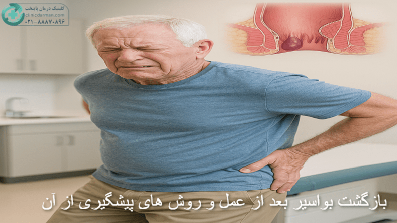 عود دوباره هموروئید
