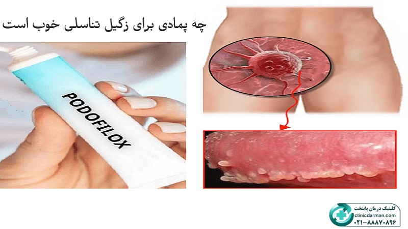 پمادهای درمان زگیل تناسلی