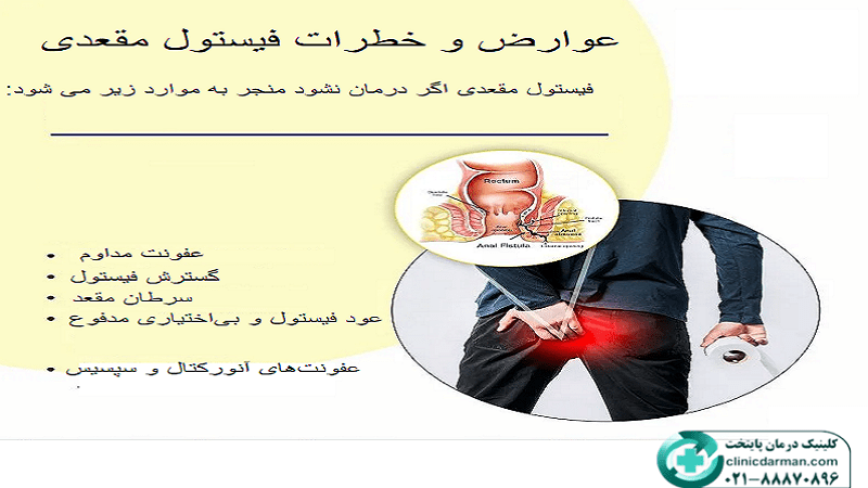 آیا فیستول خطرناک است