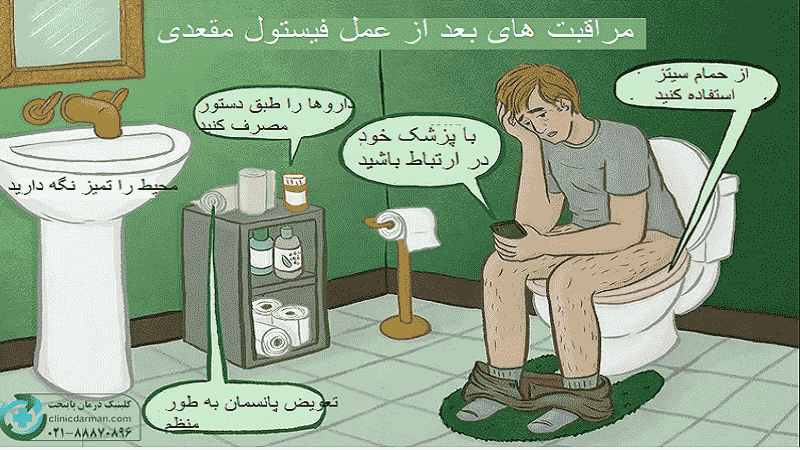 دوران نقاهت بعد از عمل فیستول