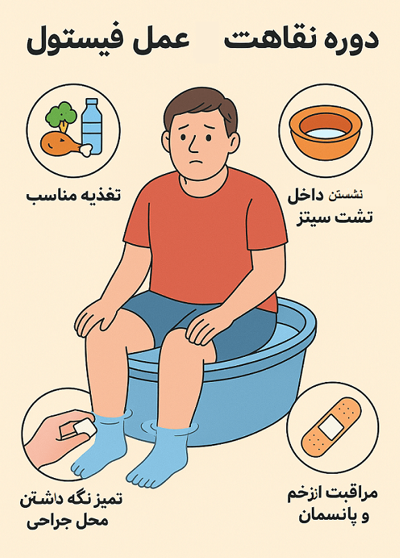 مراقبت های بعد از عمل فیستول مقعدی