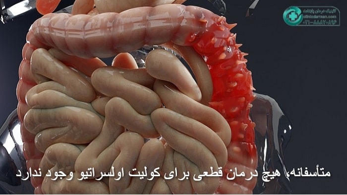 داروی جدید برای درمان بیماری کولیت روده