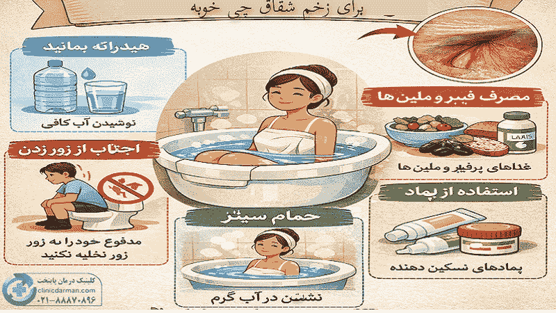 جوش خوردن زخم شقاق