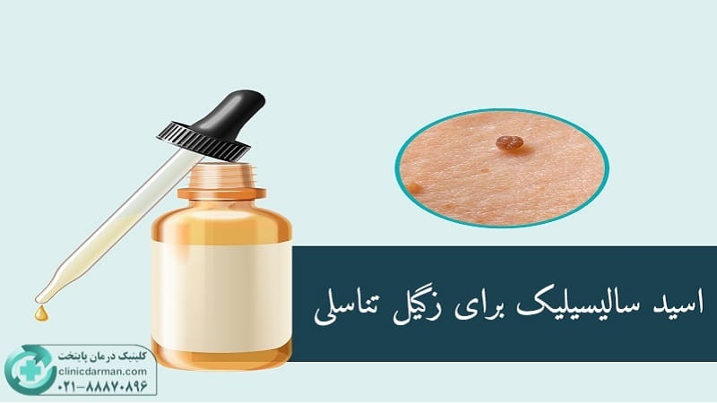 اسید سالیسیلیک برای زگیل تناسلی
