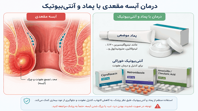 بهترین پماد برای درمان آبسه مقعدی