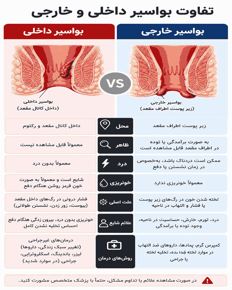 بواسیر داخلی و خارجی چه فرقی دارند