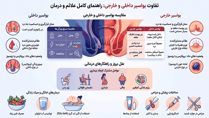 تفاوت بواسیر داخلی و خارجی چیست